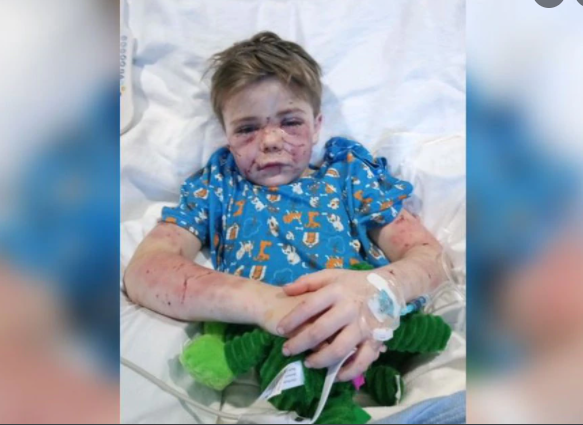 Εφιάλτης: 7χρονος δέχεται επίθεση από σκύλο - Πώς τον έσωσε η γειτόνισσα