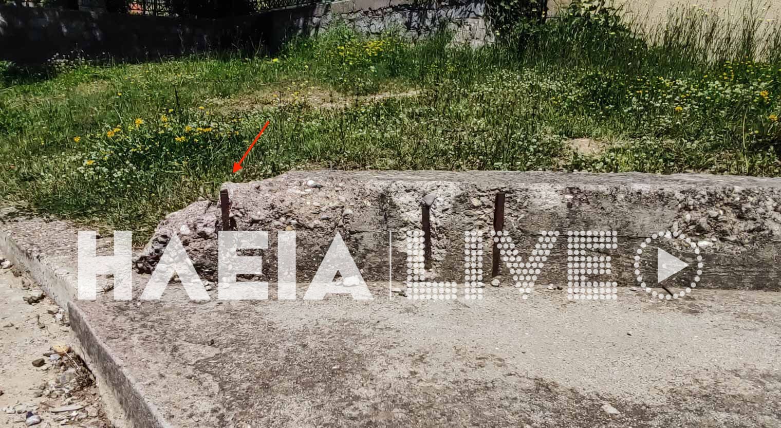 Αρχαία Ολυμπία: 5χρονη με κάταγμα κρανίου σε παιδική χαρά - Παραλίγο να χάσει το μάτι της